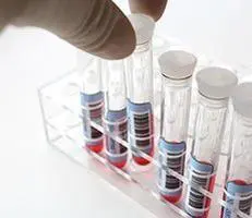 Test tubes with red liquid in rack.